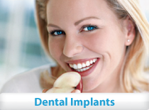 Dental Implants